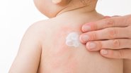 Descubra os cremes essenciais para manter a pele do seu bebê saudável e protegida. - FotoDuets / istock