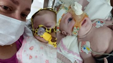 A bebê Maria Julia está internada há 3 meses e teve sua imagem roubada por golpistas da internet. - Imagem: Reprodução