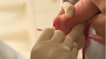 Imagem Ampliação do teste do pezinho irá acelerar diagnóstico de doenças raras