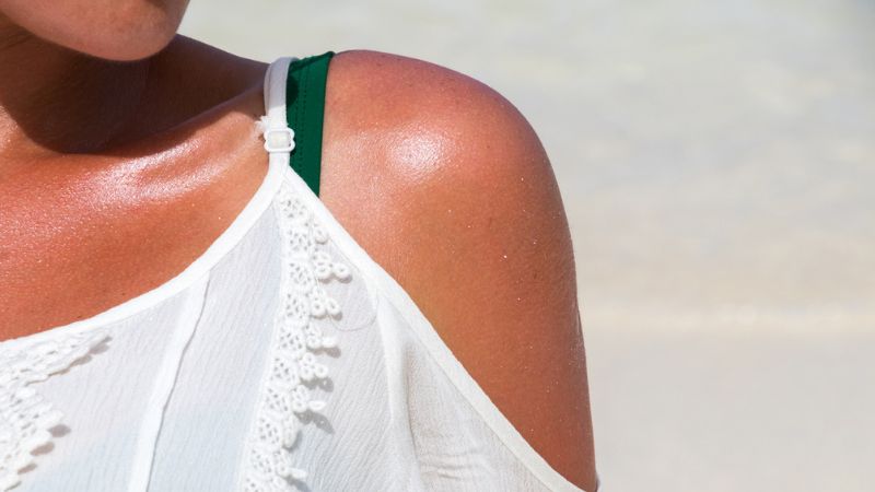 Qual a importância do cuidado com a pele depois de um dia de sol?
