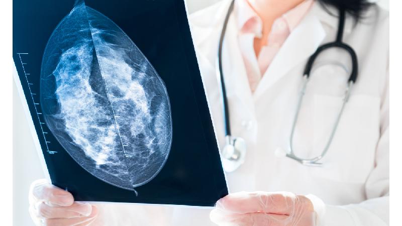 Dia Mundial da Mamografia