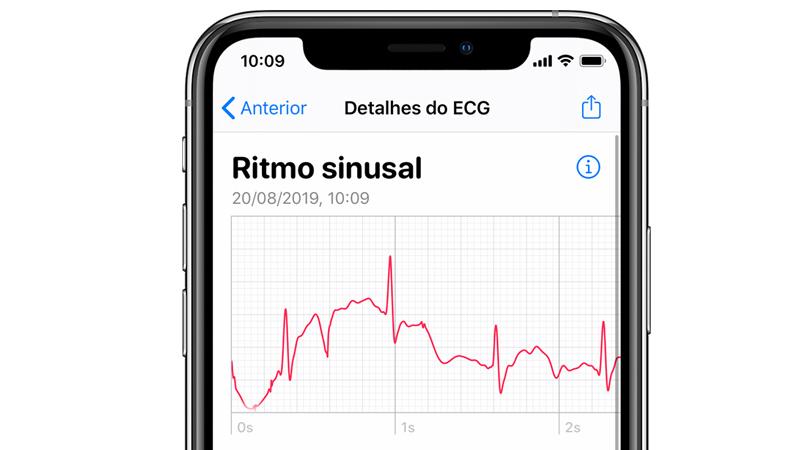 Apple Watch conta com recurso eletrocardiograma (ECG)