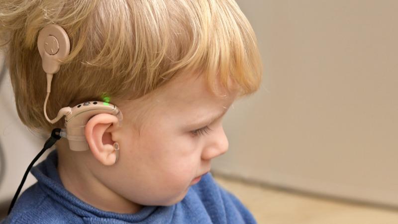 criança com perda auditiva utilizando implante coclear