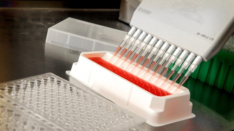 Exames PCR feitos durante a manifestação da doença costumam ter resultado negativo
